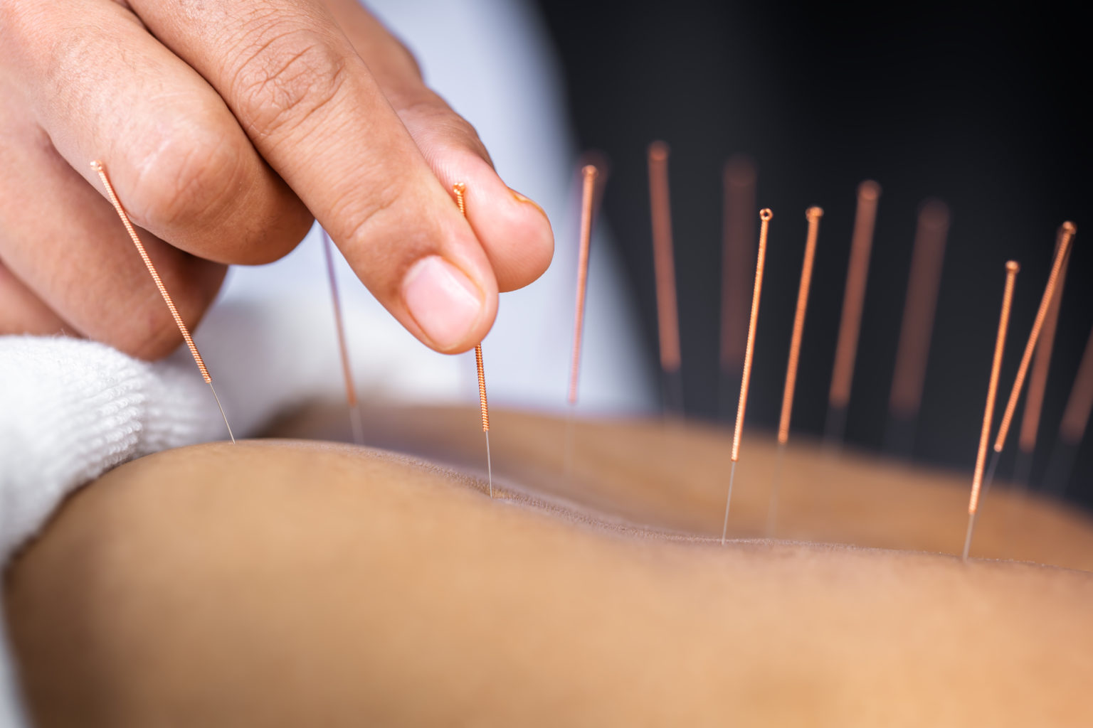 Is Acupuncture (or acupressure) Biblical? Is Traditional Chinese Medicine or Eastern Medicine something a Christian should partake&nbsp;in?